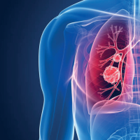 patientjourney patientjourney